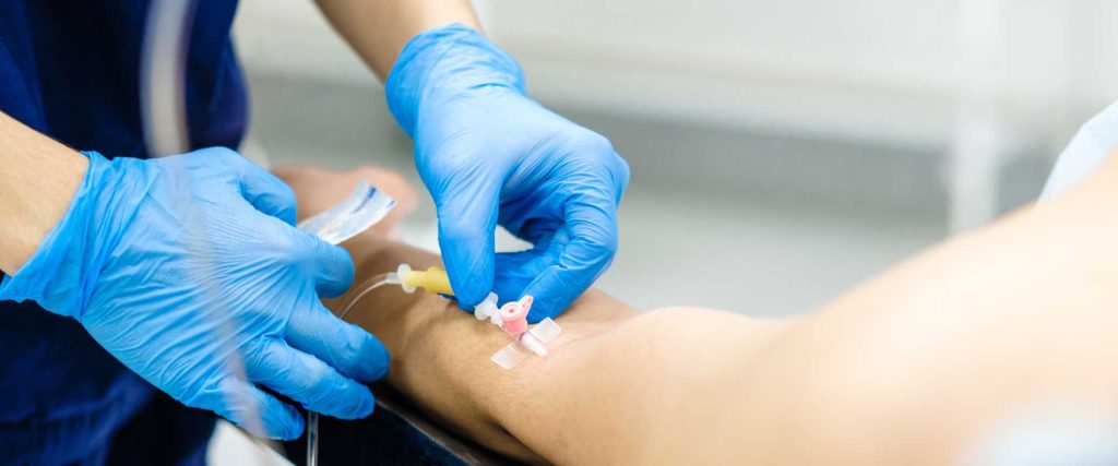 Starting a ketamine infusion at the Ketamine Research Institute
